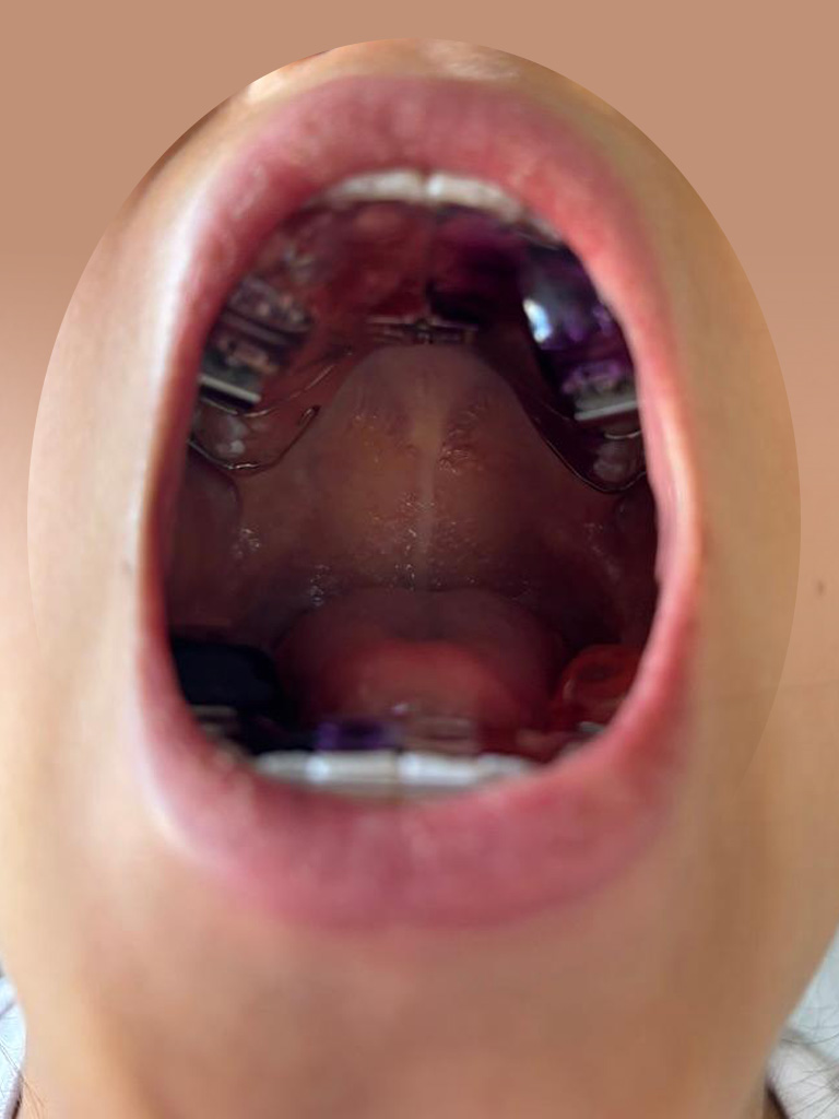 thérapie craniosacrale